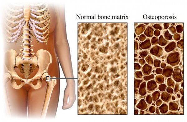 Osteosyl D3™