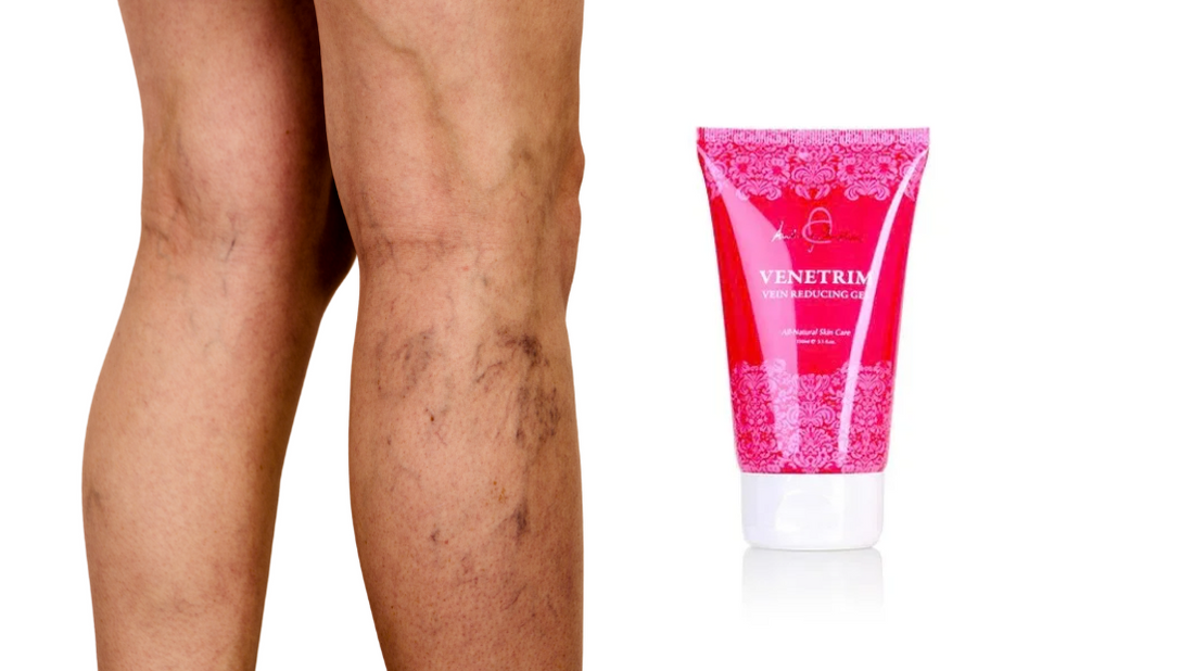 Best Creams for Varicose Veins and Leg Circulation Support