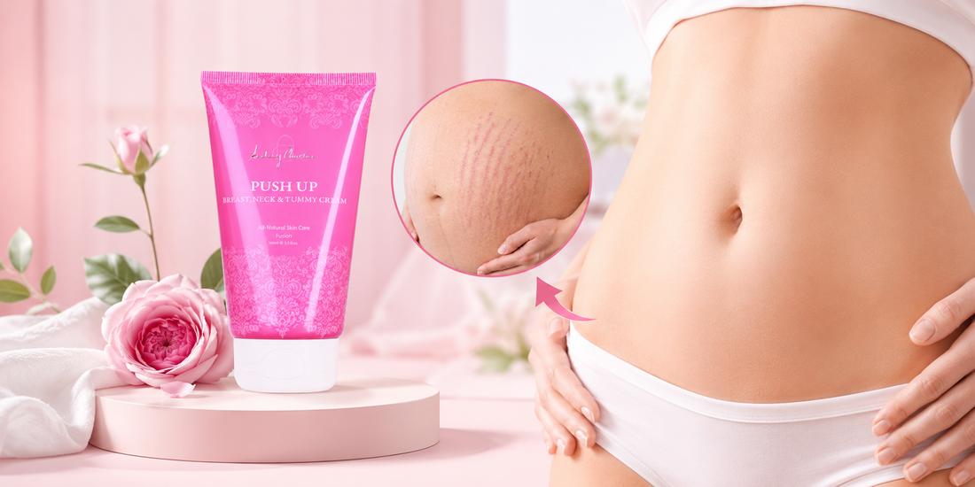 HOW TO REMOVE STRETCH MARKS (WHAT ACTUALLY WORKS)