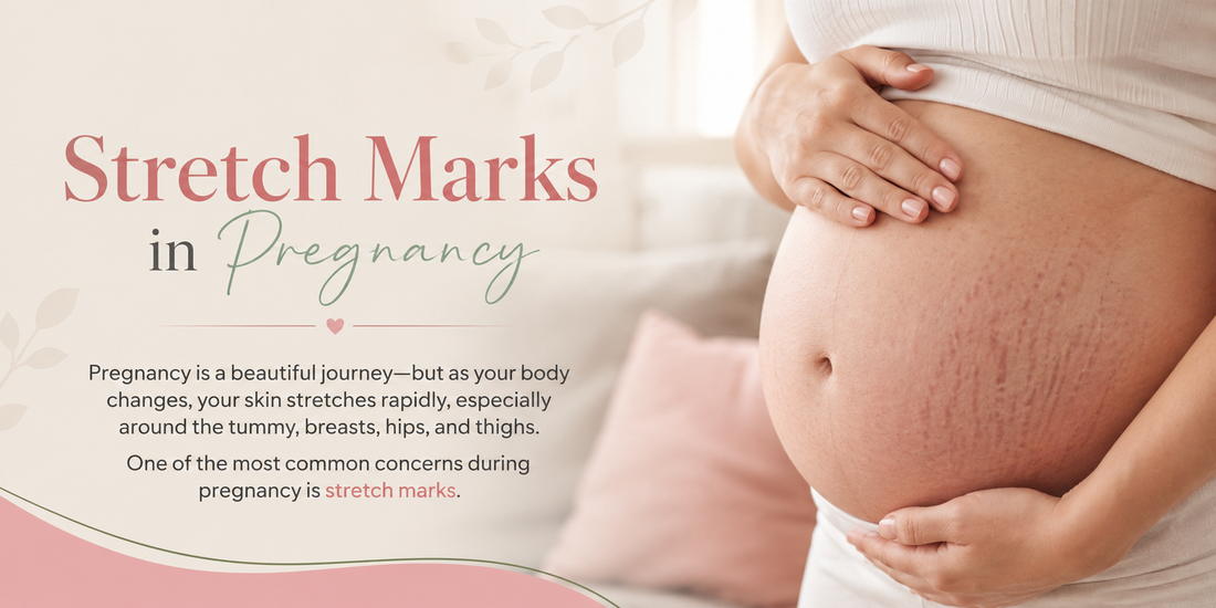 BEST CREAM FOR STRETCH MARKS DURING PREGNANCY (SAFE OPTIONS)