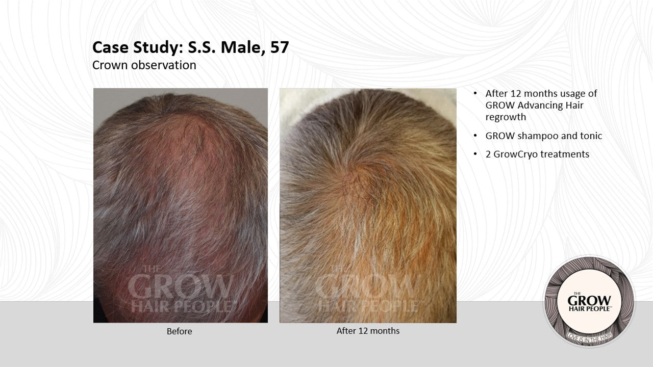 GROW Tonic - Advancing Regrowth