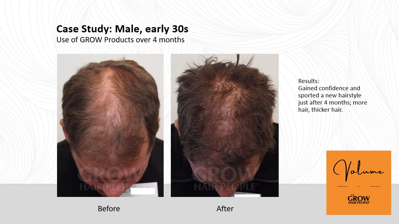 GROW Shampoo - Advancing Regrowth