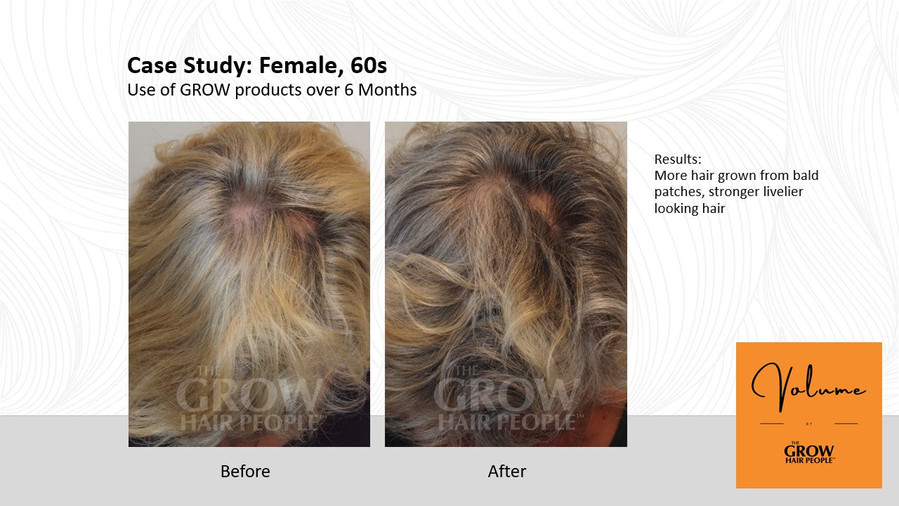 GROW Shampoo - Advancing Regrowth