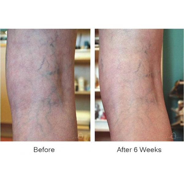 Audrey Christian VENETRIM Vein Reducing Cream